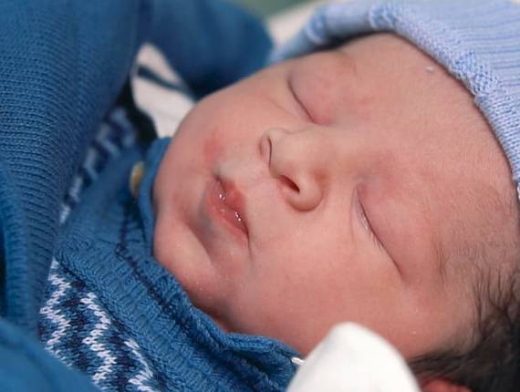 Parto Cesárea de Nascimento Henrique