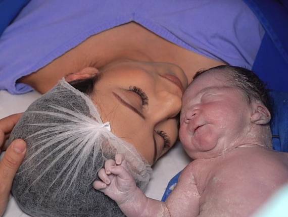 Parto Cesárea de Nascimento Lucas