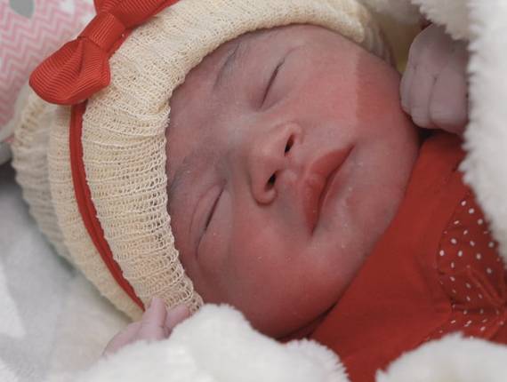 Parto Cesárea de Nascimento Lara