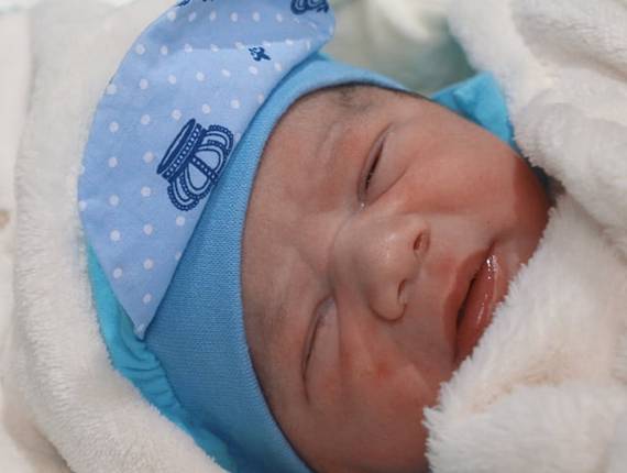 Parto Cesárea de Nascimento Levi