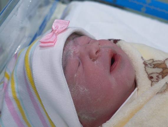 Parto Cesárea de Nascimento Júlia