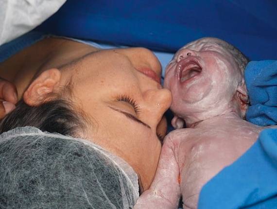 Parto Cesárea de Nascimento Lucas