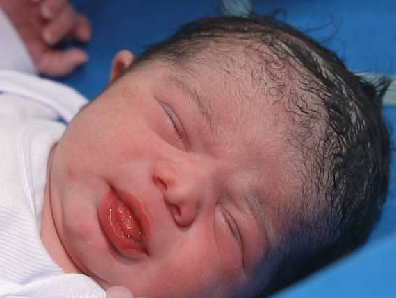 Parto Cesárea de Nascimento Davi