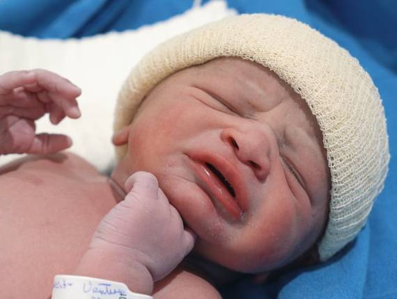 Parto Cesárea de Nascimento Miguel