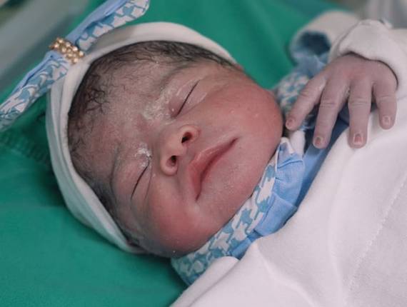 Parto Cesárea de Nascimento Isadora