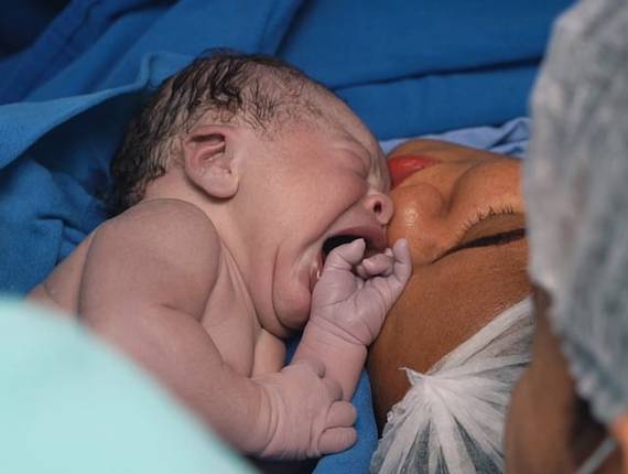 Parto Cesárea de Nascimento Lorenzo