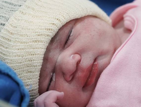 Parto Cesárea de Nascimento Maria Antonella