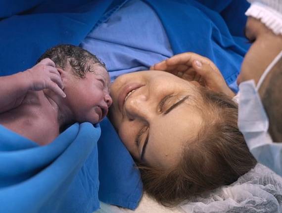 Parto Cesárea de Nascimento Lucas