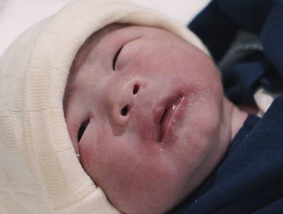 Parto Cesárea de Nascimento Leonardo