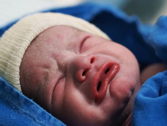 Parto Cesárea de Nascimento Samuel