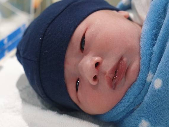 Parto Cesárea de Nascimento Vicente