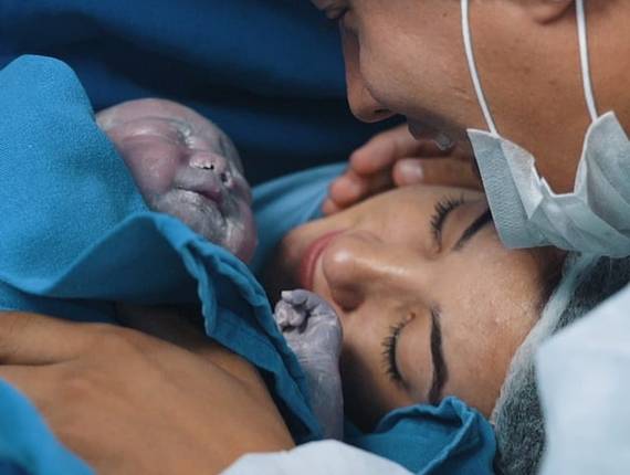 Parto Cesárea de Nascimento Miguel