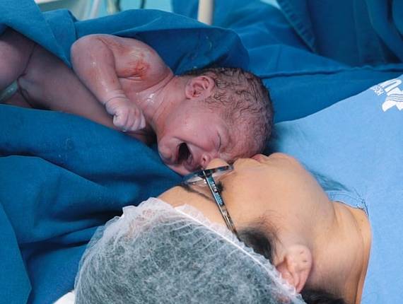 Parto Cesárea de Nascimento Hadassa