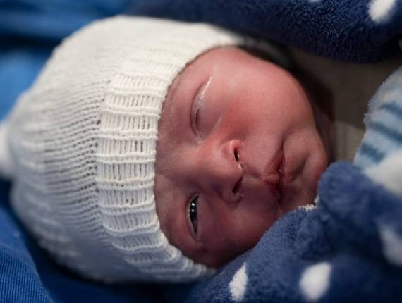 Parto Cesárea de Nascimento Vicente