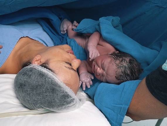 Parto Cesárea de Nascimento Antonio Sérgio