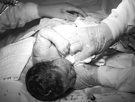 Parto Cesárea de Nascimento Ester