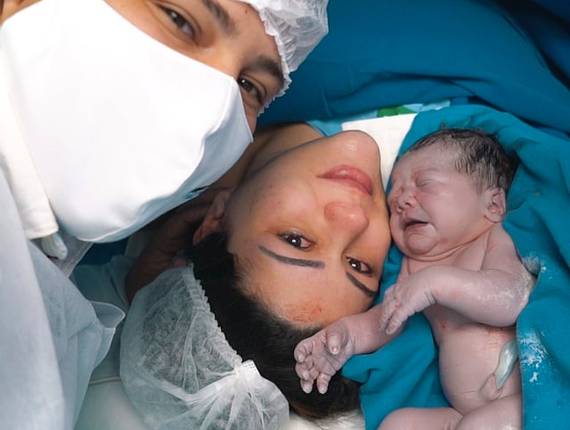 Parto Cesárea de Nascimento Alice