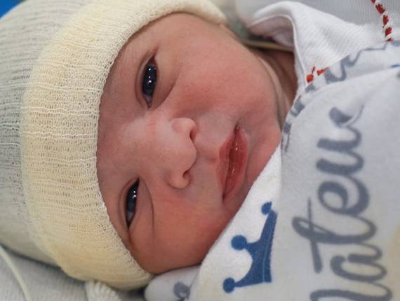 Parto Cesárea de Nascimento Mateus