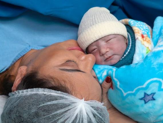 Parto Cesárea de Nascimento Théo