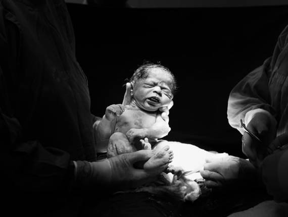 Parto Cesárea de Nascimento Maria Luiza