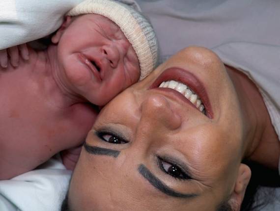 Parto Cesárea de Nascimento Lorenzo