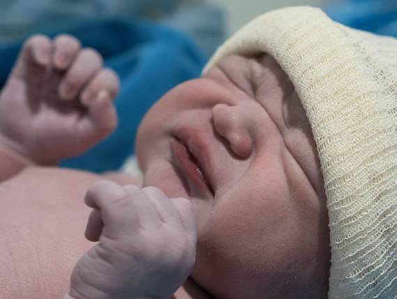 Parto Cesárea de Nascimento Arthur