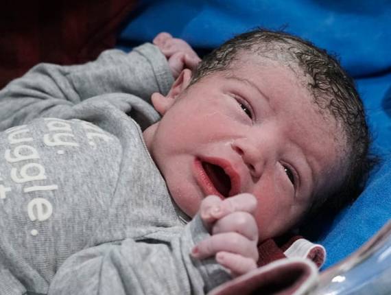 Parto Cesárea de Nascimento Leonardo