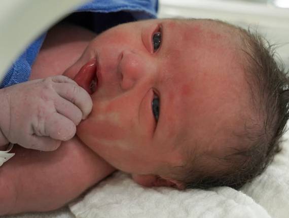 Parto Cesárea de Nascimento Gabriel Henrique