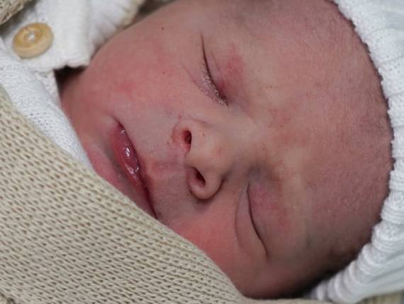 Parto Cesárea de Nascimento Luis Otávio