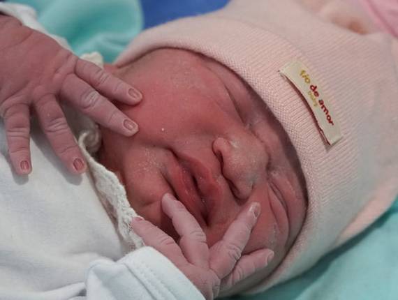 Parto Cesárea de Nascimento Sophia