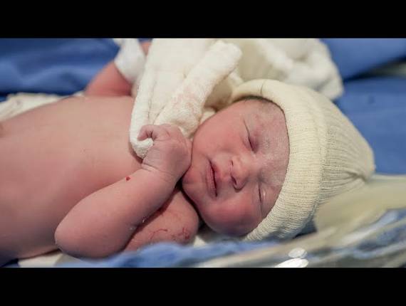 Parto Cesárea de Nascimento Stella