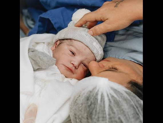 Parto Cesárea de Nascimento Francisco