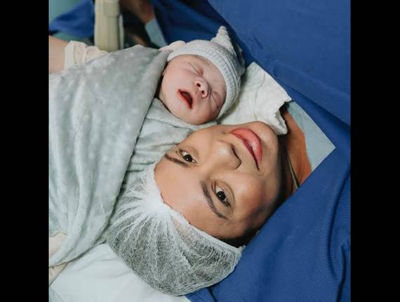 Parto Cesárea de Nascimento Bernardo 