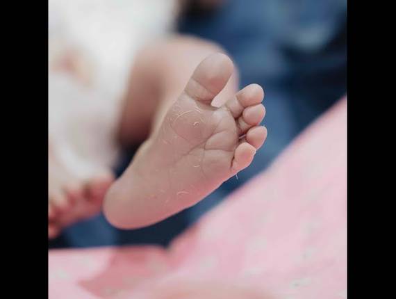 Parto Cesárea de Nascimento Laura