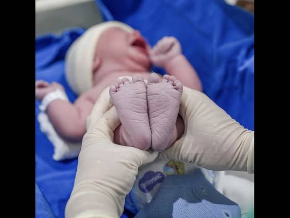 Parto Cesárea de Nascimento Rafael