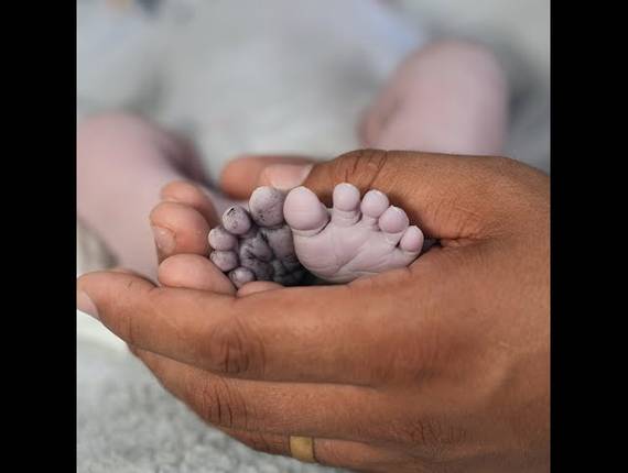 Parto Cesárea de Nascimento Mateo