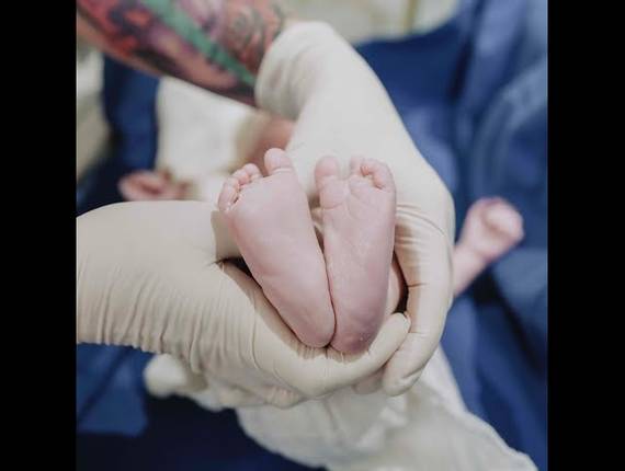 Parto Cesárea de Nascimento Antonella