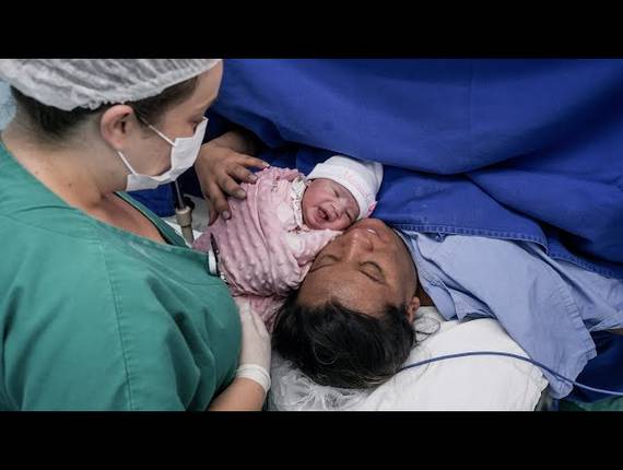 Parto Cesárea de Nascimento Manuela