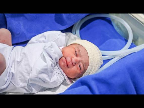 Parto Cesárea de Nascimento Ísis