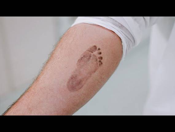 Parto Cesárea de Nascimento Heitor 