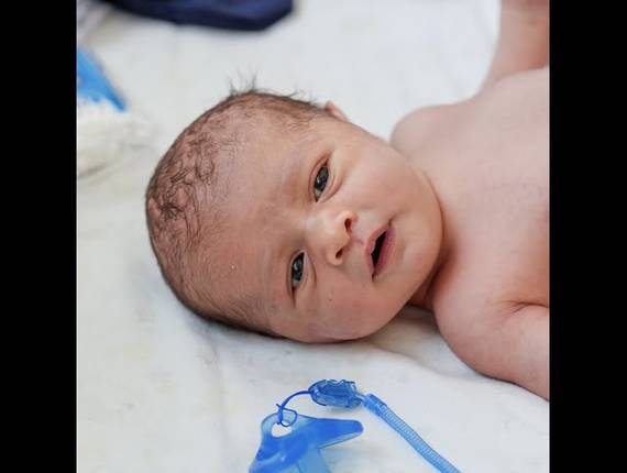 Parto Cesárea de Nascimento Miguel 