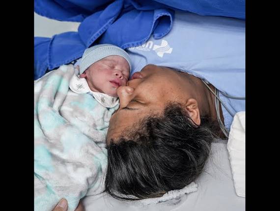 Parto Cesárea de Nascimento João Lucas