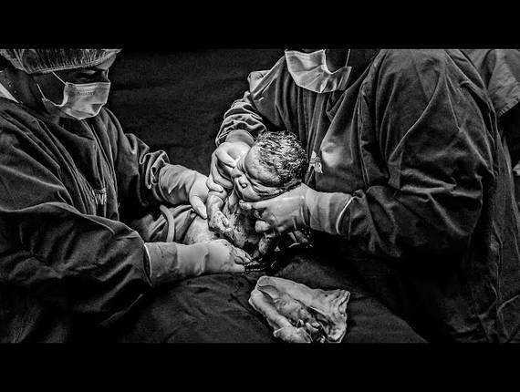 Parto Cesárea de Nascimento Maya