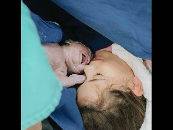 Parto Cesárea de Nascimento Eloah Maria