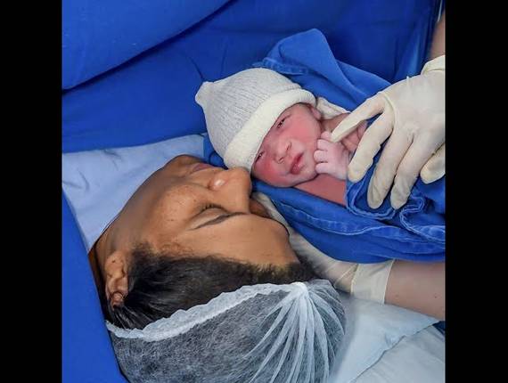 Parto Cesárea de Nascimento Pietra