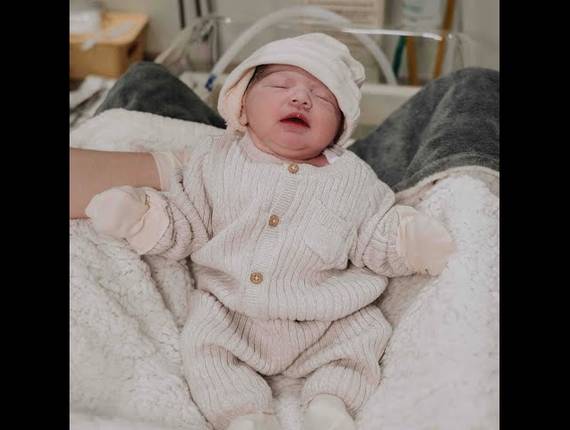 Parto Cesárea de Nascimento Henry 