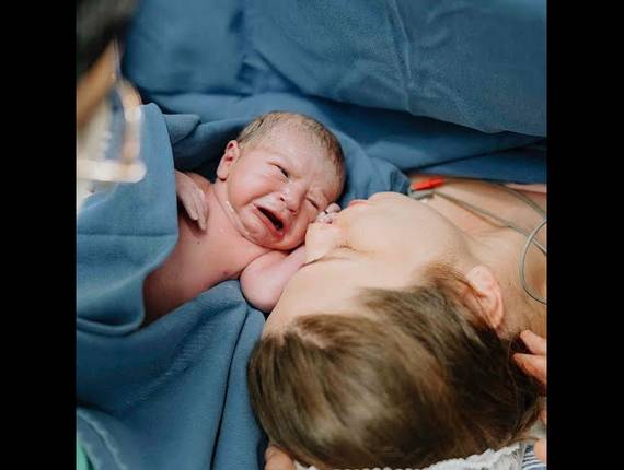 Parto Cesárea de Nascimento Vicente