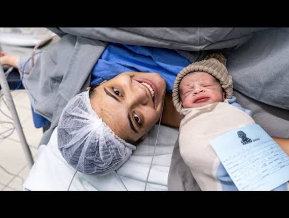 Parto Cesárea de Nascimento Miguel