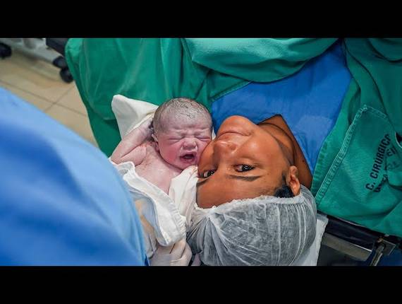 Parto Cesárea de Nascimento Leonardo