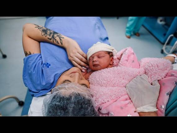 Parto Cesárea de Nascimento Antônia